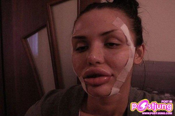 เธอทำศัลยกรรมเลียนแบบอะไร