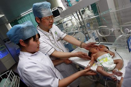 โถ๋ลูกแม่! ทารกแฝดจีนเกิดมาผิดปกติ "มี 2 หัวในร่างเดียว"
