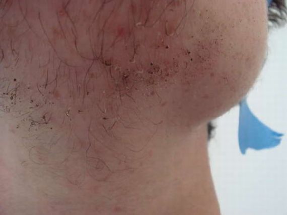 OMG !!! โกนหนวดด้วยไฟแช็ค