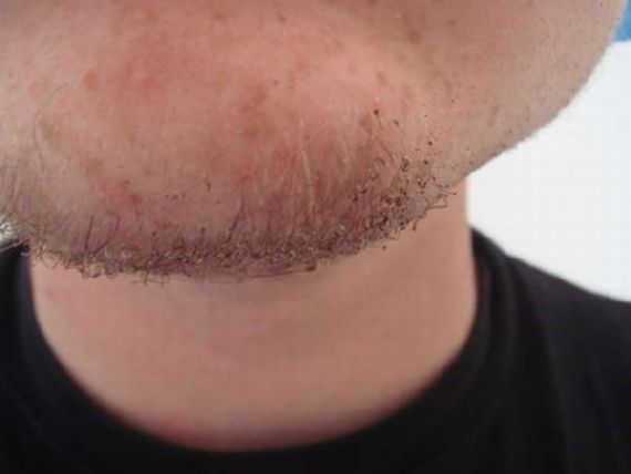 OMG !!! โกนหนวดด้วยไฟแช็ค