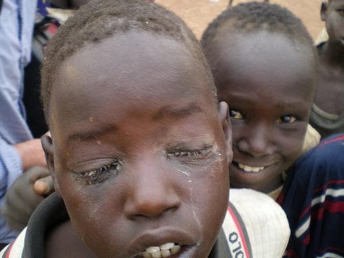 เด็กแอฟริกาอดอยากไม่มีอาหารและน้ำจะกิน