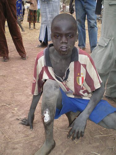 การทารุณกรรมและการละเลยต่อเด็ก เห็นแล้วน่าสงสารนะครับ