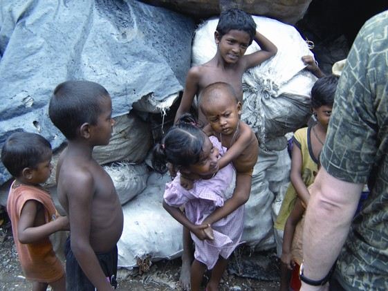 การทารุณกรรมและการละเลยต่อเด็ก เห็นแล้วน่าสงสารนะครับ