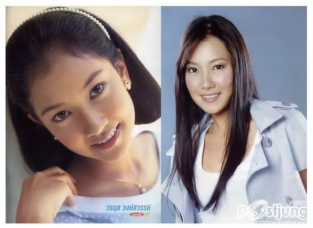 ดาราbefore and after ภาค 1 ค่ะ