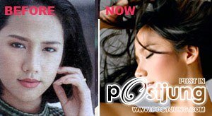 ดาราbefore and after ภาค 1 ค่ะ