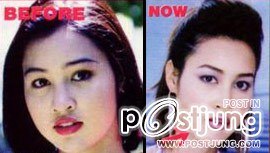 ดาราbefore and after ภาค 1 ค่ะ