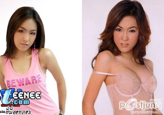 ดาราbefore and after ภาค 1 ค่ะ