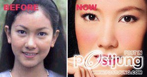 ดาราbefore and after ภาค 1 ค่ะ