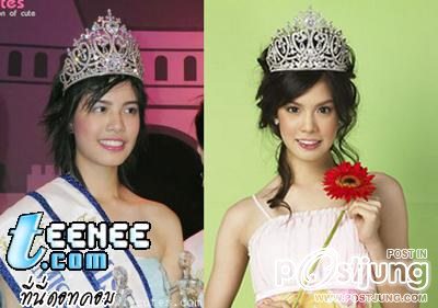 ดาราbefore and after ภาค 1 ค่ะ