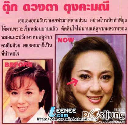 ดาราbefore and after ภาค 1 ค่ะ