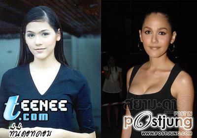 ดาราbefore and after ภาค 1 ค่ะ