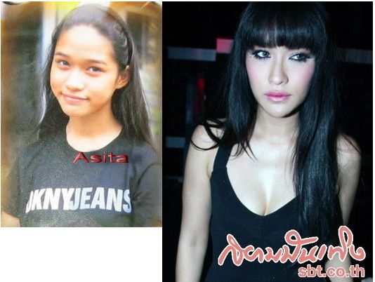ดาราbefore and after ภาค 1 ค่ะ