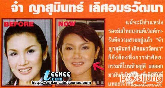 ดาราbefore and after ภาค 1 ค่ะ