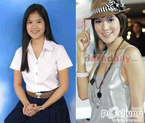 ดาราbefore and after ภาค 1 ค่ะ