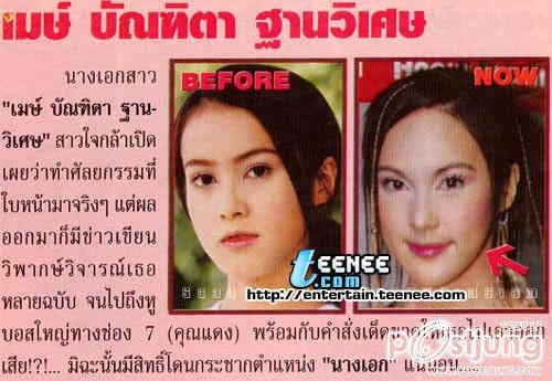 ดาราbefore and after ภาค 1 ค่ะ