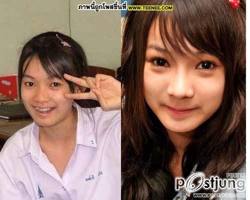 ดาราbefore and after ภาค 1 ค่ะ