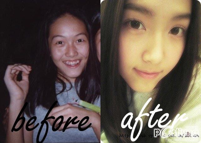 ดาราbefore and after ภาค 1 ค่ะ