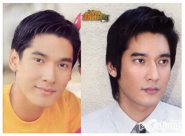 ดาราbefore and after ภาค 1 ค่ะ