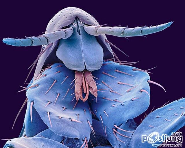Human flea head
