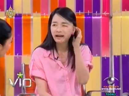 ร่วมเป็นกำลังใจให้ น้องเค้ก เหยื่อน้ำกรด กับหัวใจที่แกร่งเกินร้อย