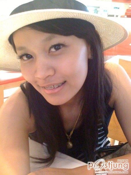 2-3 ปีที่แล้ว.ก่อนฉีดกลูต้า+โบท็อก+ฟิลเลอร์