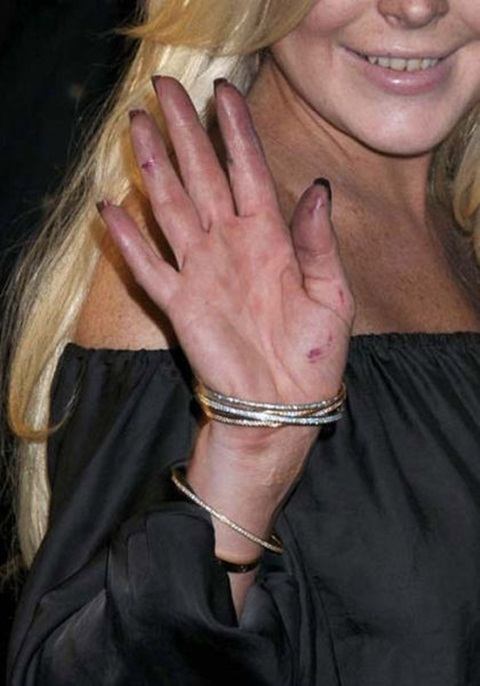 What is happening to Lindsay lohan ?
