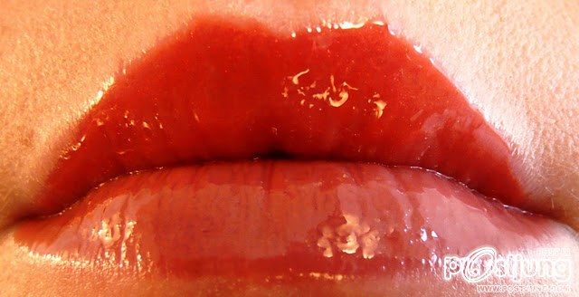 ริมฝีปากสวย เติมเต็มความเอิบอิ่ม เสน่ห์สาวอันเย้ายวน