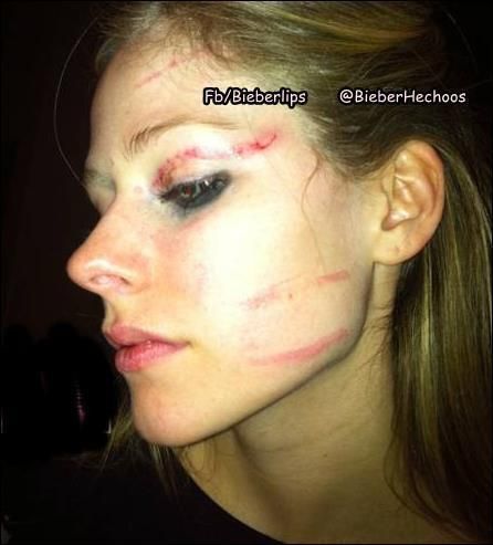 Avril Lavigne อาวริล ลาวีญ" ถูกทำร้ายร่างกาย