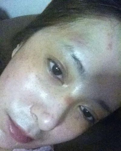 ต่าย สายธาร โพสต์ภาพถูกแฟนซ้อม ว่อนเน็ต