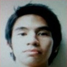  โป๊บ ยันไม่เคยขึ้นเขียงให้หมอเฉาะหน้า