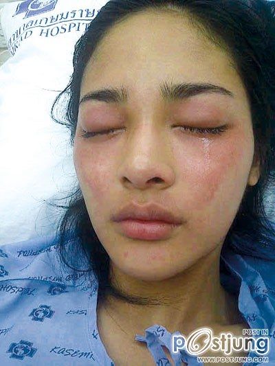 ตกใจ ''ปุ๊กลุก'' สภาพนี้