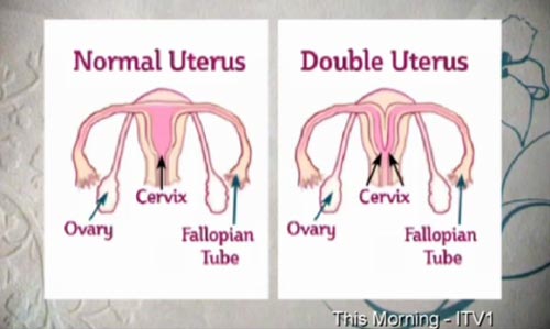 ค่ายหนังโป๊ทุ่ม 30 ล้าน ทาบสาวสองช่องคลอดเล่นหนัง