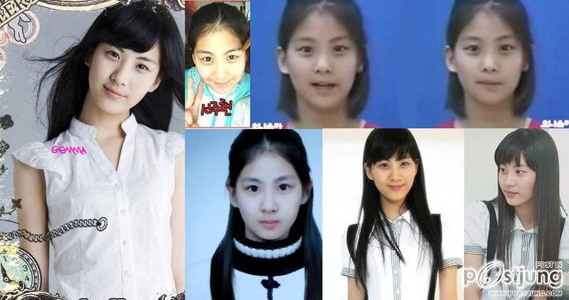 SNSD ก่อนศัลยกรรม เปรียบเทียบความต่าง ก่อน-หลังศัลยกรรม