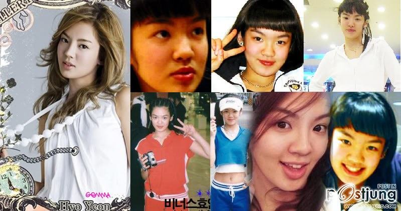 SNSD ก่อนศัลยกรรม เปรียบเทียบความต่าง ก่อน-หลังศัลยกรรม