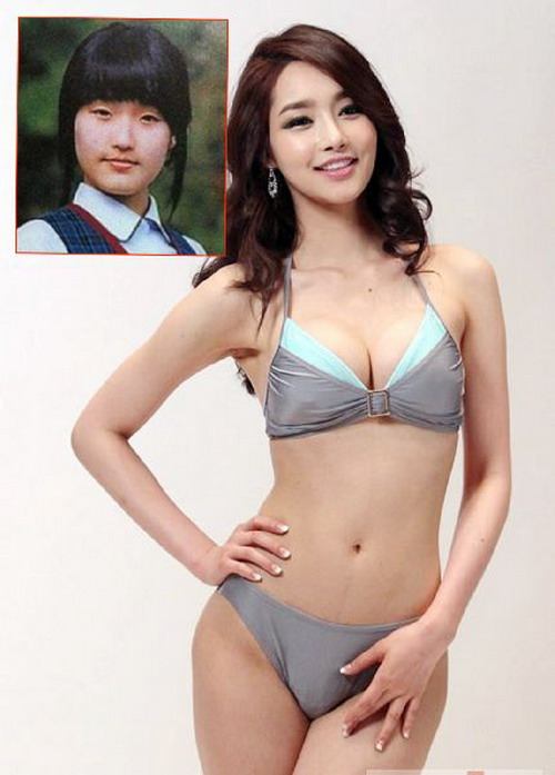 มิสเกาหลี 2012 ยันไม่เคยปิดบัง สวยด้วยมีดหมอ