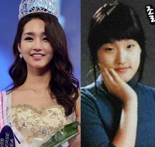 มิสเกาหลี 2012 ยันไม่เคยปิดบัง สวยด้วยมีดหมอ