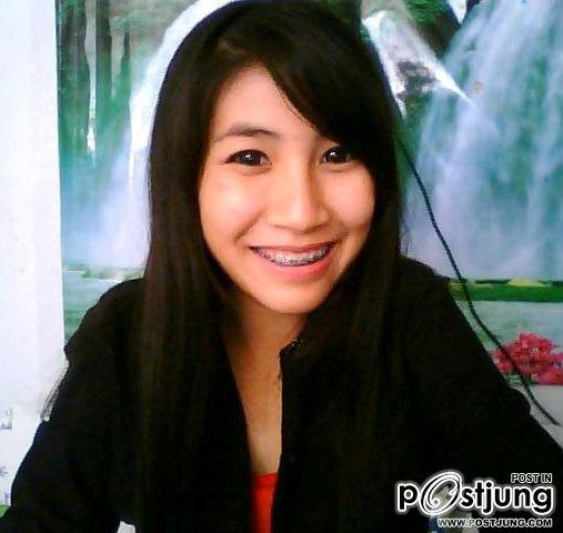 มิ้งคื ก้านกล้วยคลับ