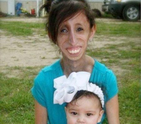 สาวป่วยแปลก! ต้องกินอาหารทุก 15 นาที เพื่อไม่ให้ตาย