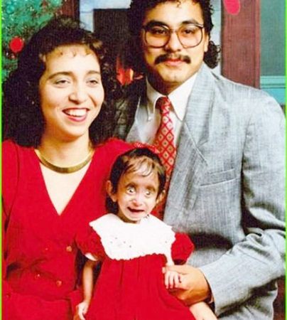 สาวป่วยแปลก! ต้องกินอาหารทุก 15 นาที เพื่อไม่ให้ตาย