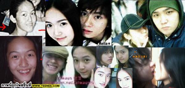 เคยจัดฟัน