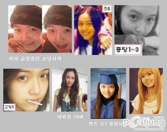 เคยจัดฟัน