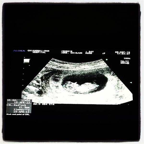 พลอย ชิดจันทร์ ดี๊ด๊า! ป่องลูกคนที่ 3 แล้วจ้า