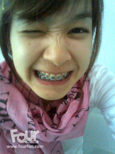 น่ารักสมัยดัดฟัน ^^