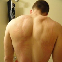 เป็นรอยเลย