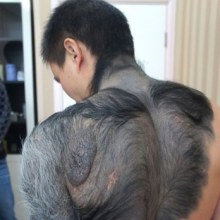 หนุ่มจีน ทรมาน โดนล้อ ขนยาวเหมือนลิง