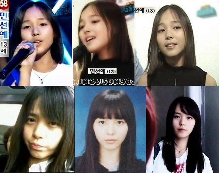 เกาหลีก่อนทำศัลยกรรม