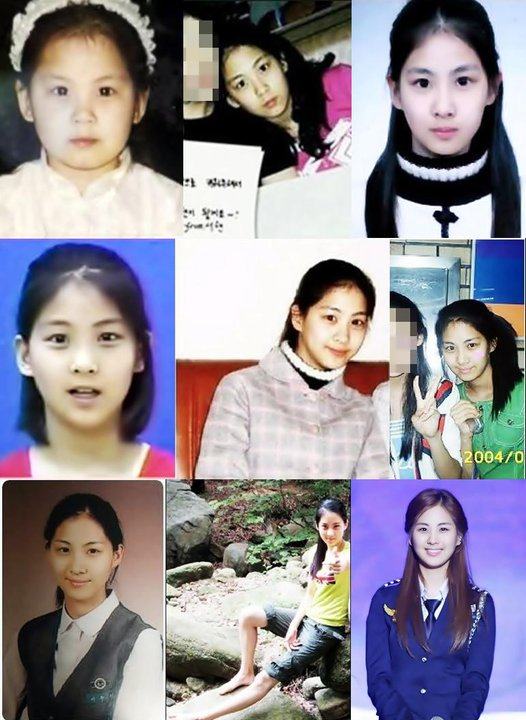 เกาหลีก่อนทำศัลยกรรม