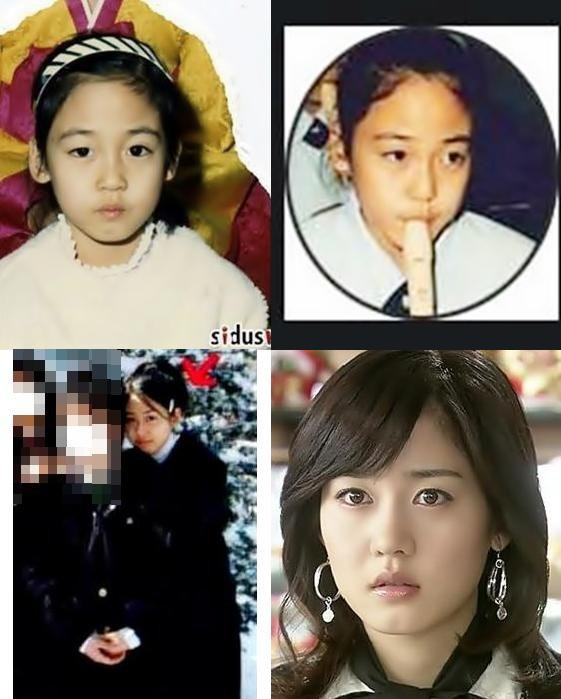 เกาหลีก่อนทำศัลยกรรม