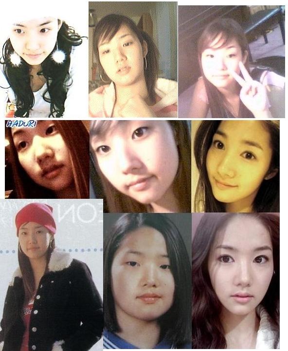 เกาหลีก่อนทำศัลยกรรม