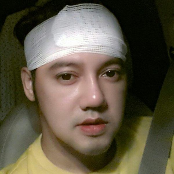 ซูมกันชัด ๆ หน้า ดีเจเจ๊แหม่ม หลังการทำศัลยกรรม